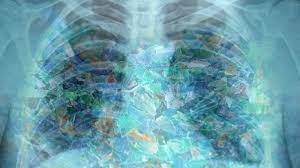 Científicos descubrieron partículas de plástico en los pulmones de personas vivas