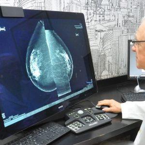 Dos argentinos crearon un mamógrafo 3D y ya trataron el cáncer de 700 mil mujeres