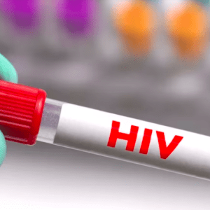 Hallan una proteína que ayuda al virus del VIH a permanecer latente