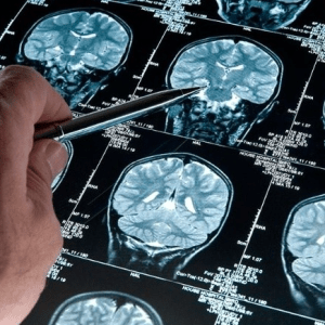 Un grupo de científicos inventaron una computadora que utiliza neuronas humanas y un poderoso hardware
