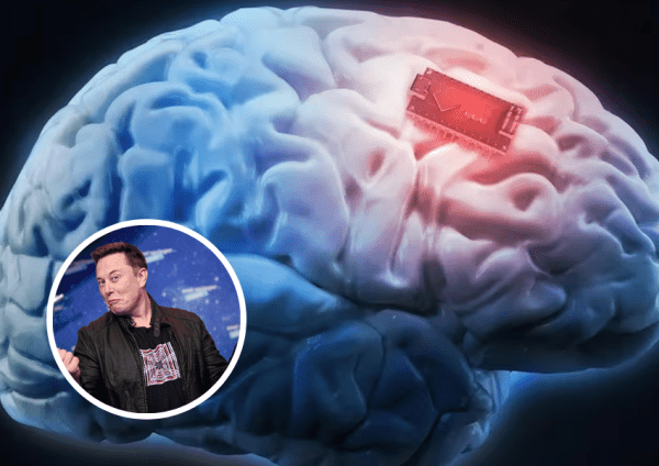Elon Musk lo hizo de nuevo: Neuralink implantó su primer chip cerebral en un humano y así funciona