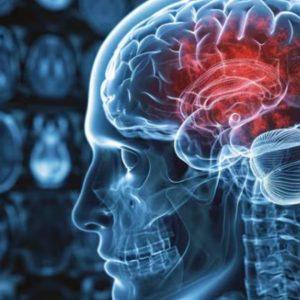 Por qué la contaminación aérea se asemeja a dos enfermedades neurodegenerativas