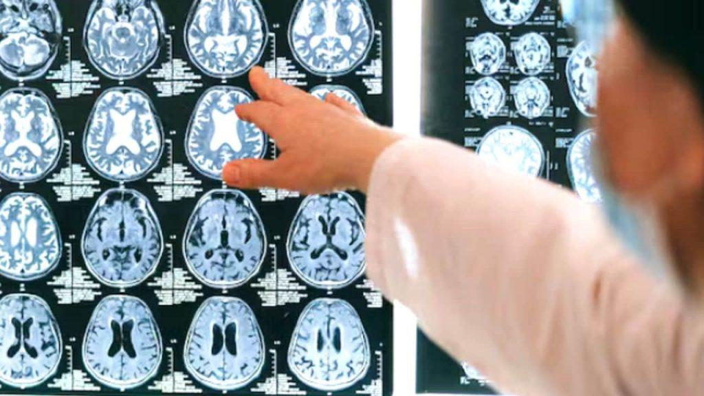 Un estudio revela qué alimento es capaz de regenerar las neuronas