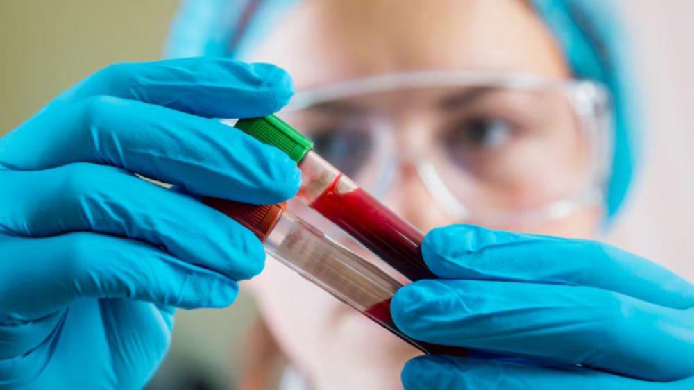 Científica argentina usó la plata de un concurso de TV para crear revolucionario test de detección del cáncer