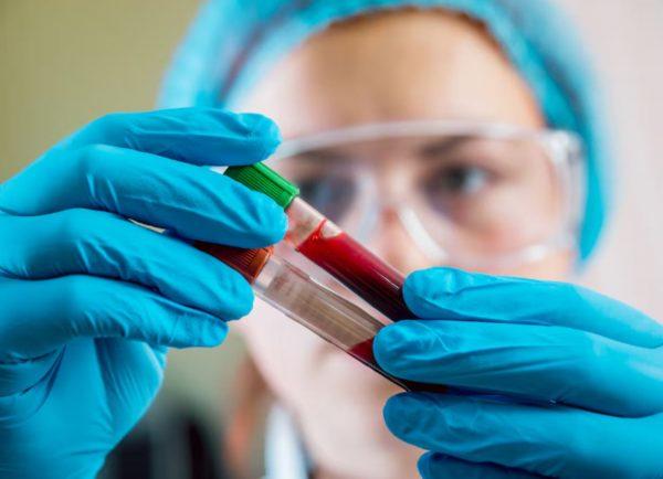 Científica argentina usó la plata de un concurso de TV para crear revolucionario test de detección del cáncer