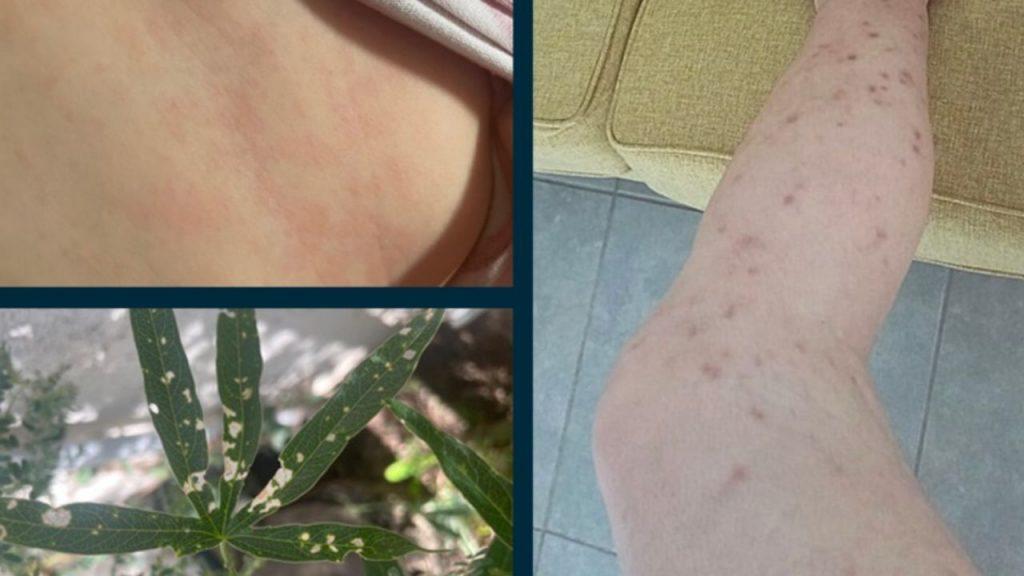 Collage de imágenes que muestra manchas rojizas en la piel de una persona, lesiones oscuras distribuidas por una pierna y hojas de una planta con manchas blanquecinas